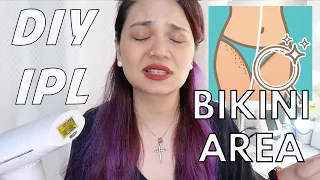 DIY IPL: Bikini Area Update (Lescolton IPL Review for Bikini Area) 2020