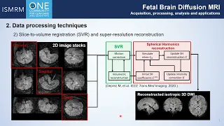 Fetal Brain Diffusion MRI