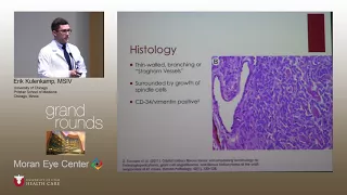 Management of Recurrent Orbital Hemangiopericytoma