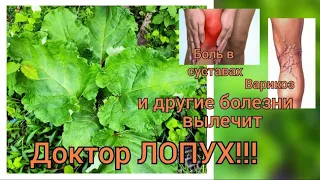 Компресс из лопуха. Что делать, если болят колени.