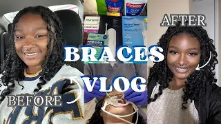 Braces Vlog| Come with me to get my braces, First 24HRS with braces, What I eat &More| JAMARI EREECE