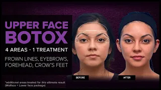 Upper Face Rejuvenation with BOTOX® at Mabrie Facial Institute