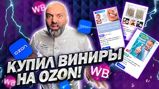 Купил ВИНИРЫ на OZON! Стоматолог распаковывает товары с Wildberries и Ozon