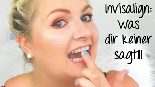 Invisalign Zahnspange: Was der Zahnarzt dir nicht sagt!!! ♡ Tipps