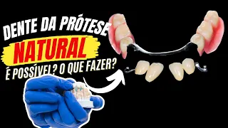 Faça a escolha CERTA dos dentes da sua PRÓTESE ou sua dor de cabeça pode ser grande!!