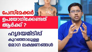 ഹൃദയമിടിപ്പ് കുറഞ്ഞാലുള്ള രോഗ ലക്ഷണങ്ങൾ | What is a pacemaker | Dr Gagan Velayudhan