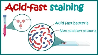 ACID FAST STAINING | Acid fast organisms | Bacterial Staining Technique | Microbiology