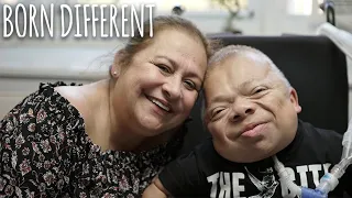 Doctors Said We Wouldn't Survive | BORN DIFFERENT