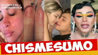 CHISMESUMO#133 KUNNO pelea con DIANA/ROD DOME hablan de FER/ CAROL filtra video/ BRIANDA en hospital