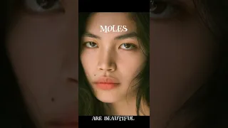 Moles are a great addition to anyone!😉 #beautiful #insecurity #beauty #cute #moles