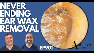 NEVERENDING EAR WAX REMOVAL - EP901