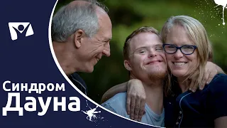 Всесвітній день людей із синдромом Дауна. Сонячні діти чи генетична аномалія? | Вісті Надії