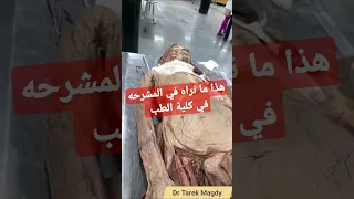 شاهد داخل مشرحة كلية الطب