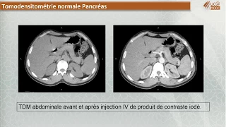 FMPM MOOCs - Radiologie digestive, Imagerie du pancréas - Pr.  N. Cherif Idrissi El Ganouni