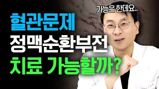 정맥순환부전! 초기에 잡아야 하는 이유