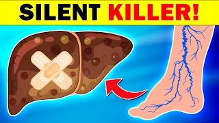 DANGER! These Foot Symptoms Signal SERIOUS Liver Risk!