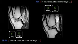Imaging of Knee joint part 1   Prof Dr  Mamdouh Mahfouz In Arabic