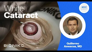 BIONIKO | SURGEON SPOTLIGHT - GUILLERMO AMESCUA | WHITE CATARACT