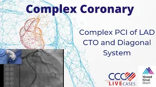 Complex PCI of LAD CTO and Diagonal System - December 16, 2014 Webcast