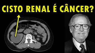 CISTO Renal: Quando é CÂNCER ou é BENIGNO ? Conheça a Classificação BOSNIAK !