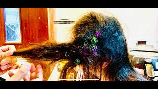BUNCHEMS STUCK IN HAIR OF A TEN YEAR OLD GIRL!!