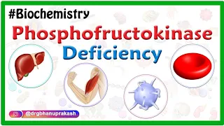 Phosphofructokinase deficiency Animation (Tarui disease / Glycogen-Storage Disease Type VII )  USMLE