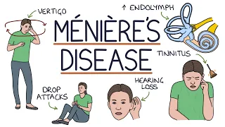 Understanding Ménière’s Disease