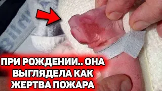 Когда малышка родилась, она выглядела не как все... Долгое время мама терпела оскорбления и хранила