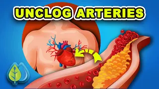 Top 7 Natural Ways to Unclog Arteries | Clean Your Arteries & Prevent Heart Attack