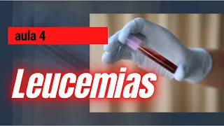 LEUCEMIAS - AULA 4 - Hematologia