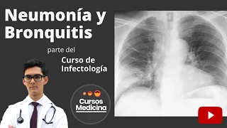 Neumonía y Bronquitis - Infectología