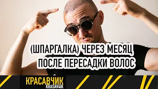 ЗАПРЕТЫ! Первый месяц после операции по пересадке волос: Какие ощущения? / Красавчик