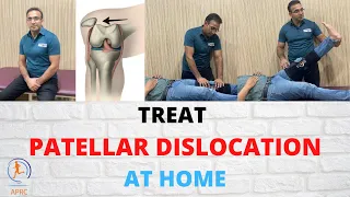 Learn Everything About Patella or knee cap  Dislocation | Treatment & Best Exercises| In Urdu/Hindi