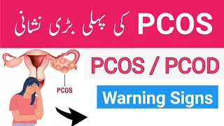 8 Signs You have PCOS - PCOD Polycystic Ovarian Syndrome Urdu Hindi - Irfan Azeem