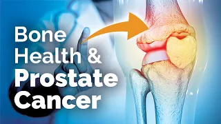 Advanced Prostate Cancer: Optimizing Bone Health