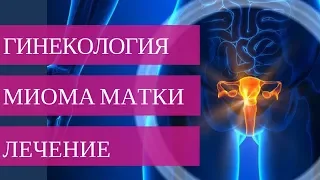 Методы лечения МИОМЫ МАТКИ. Обязательно к просмотру женщинам после 40 лет!