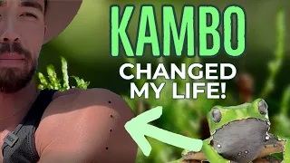 Kambo Changed My Life!! 🐸💯