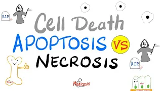 Apoptosis Vs Necrosis | Comparison | Cell Death | Pathology Lectures