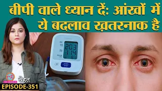 High Blood Pressure से हो सकती है Hypertensive Retinopathy यानी आंखें खराब | Sehat ep 351