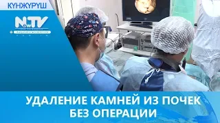 УДАЛЕНИЕ КАМНЕЙ ИЗ ПОЧЕК БЕЗ ОПЕРАЦИИ