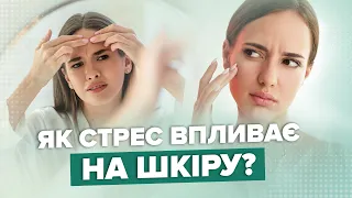 Влив стресу на стан шкіри / Як правильно доглядати за шкірою / Головні поради