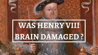WAS HENRY VIII A BRAIN DAMAGED KING? | Henry VIII’s jousting accidents | Tudors | History Calling