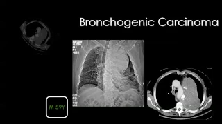 Chest II Prof.Dr. Mamdouh Mahfouz