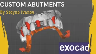 Fastest Exocad Video Tutorial - How To Design Custom Abutments