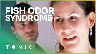 What Is It Like to Live with Fish Odor Syndrome (Bad Breath Syndrome) | The Food Hospital | Tonic