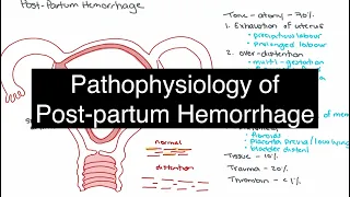 Pathophysiology of Postpartum Hemorrhage