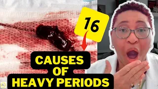 The Shocking Reality of Heavy Period Flow: 16 Potential Causes