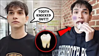 Lucas and Marcus | My Tooth Was Knocked Out By Someone At The Store | Dobre Brothers