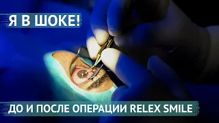 Лазерная коррекция зрения Smile / до, во время и после операции