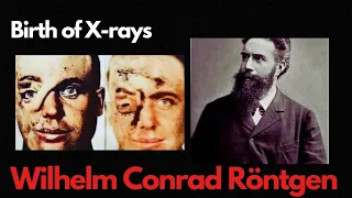 The Radiant Revolution: Wilhelm Conrad Röntgen and the Birth of X-rays